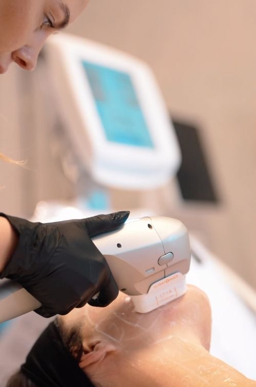 Ultherapy 面部療程實拍