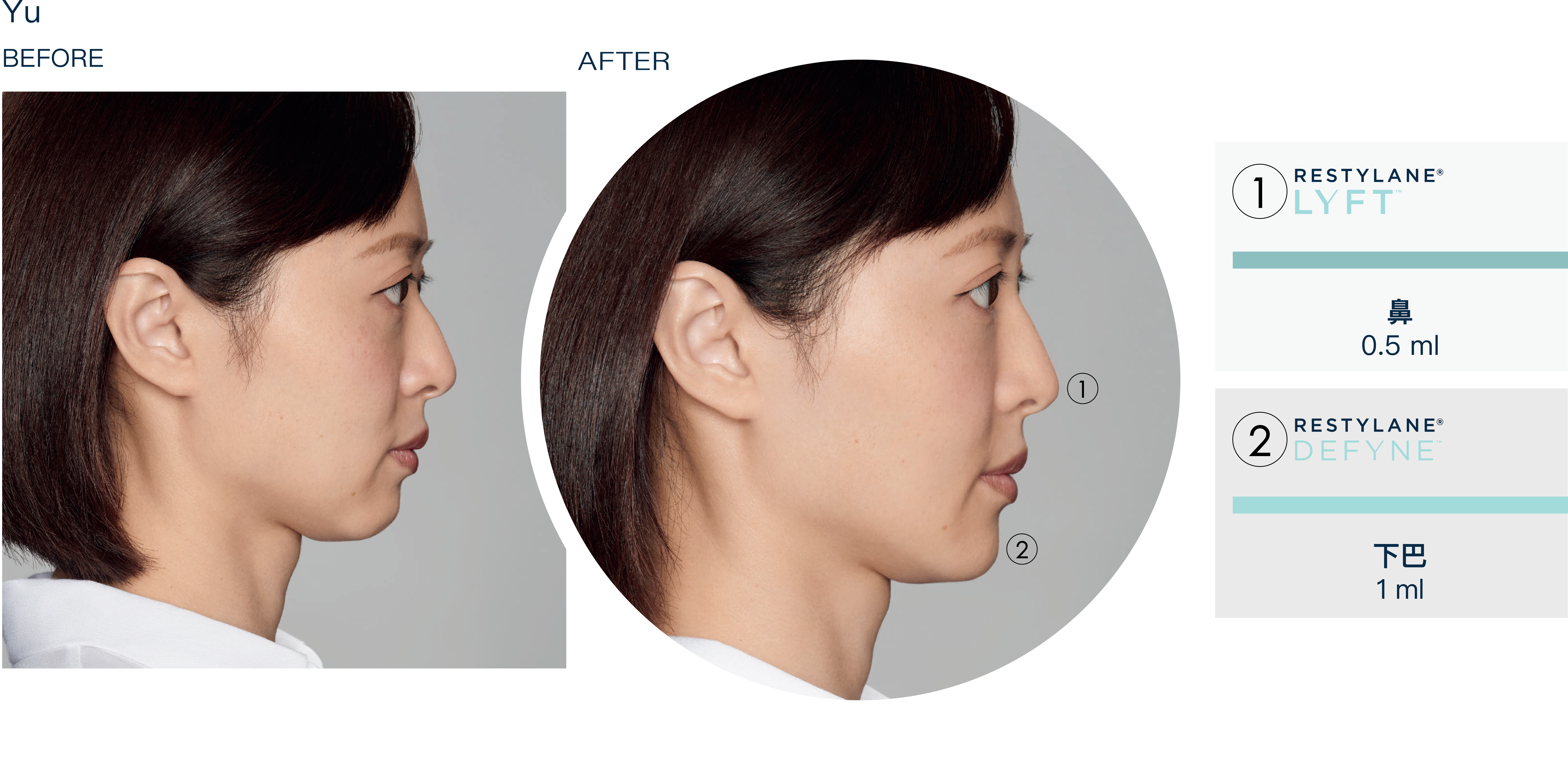 整體年輕化效果